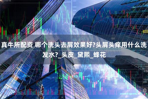 真牛所配资 哪个洗头去屑效果好?头屑头痒用什么洗发水?_头皮_黛熙_蜂花
