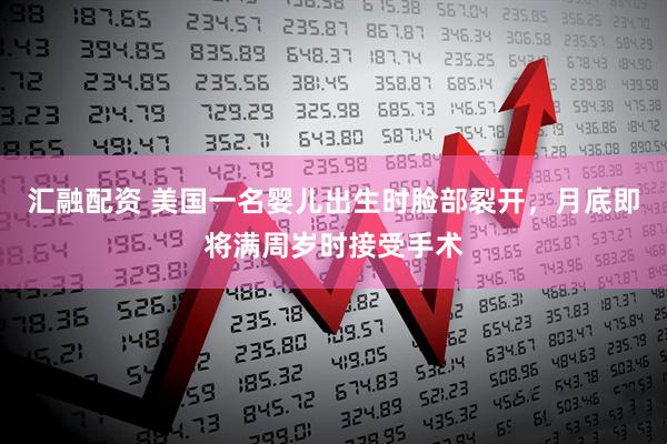 汇融配资 美国一名婴儿出生时脸部裂开，月底即将满周岁时接受手术